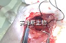 心肌梗死_wm.jpg