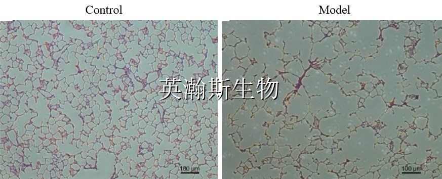 肺气肿模型_wm.jpg