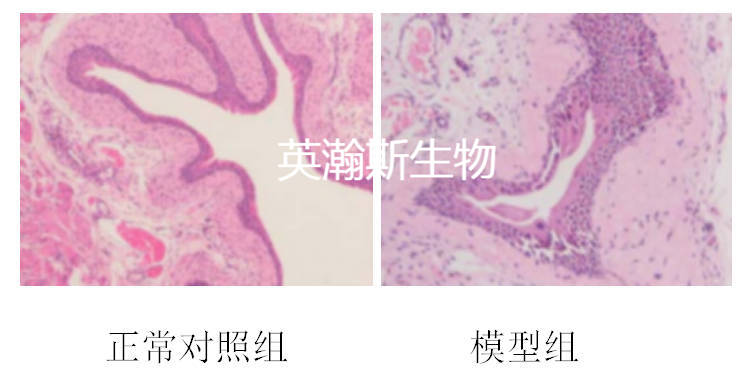 膀胱炎.jpg