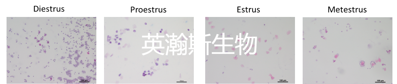 动情周期.png